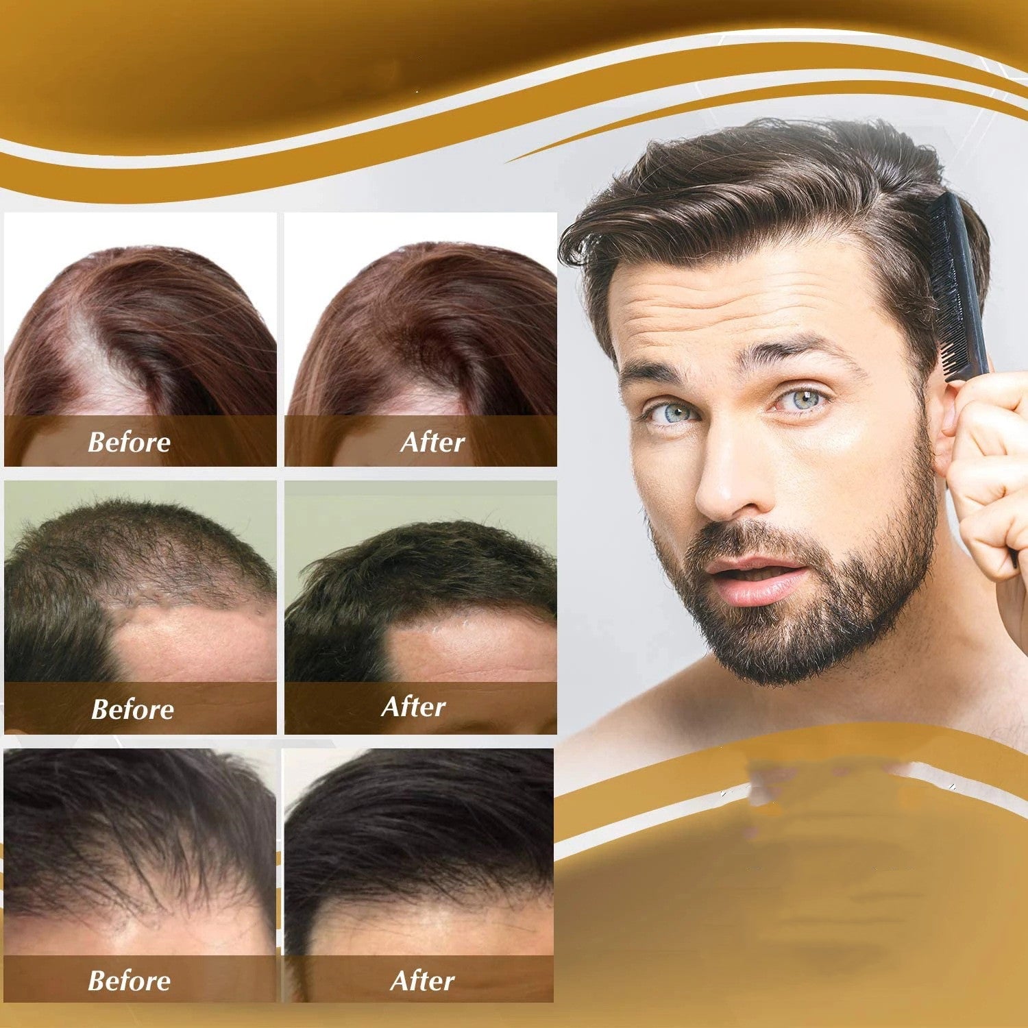Hair Growth & Nourishing Serum – Anti Hair Loss Treatment (20ml)