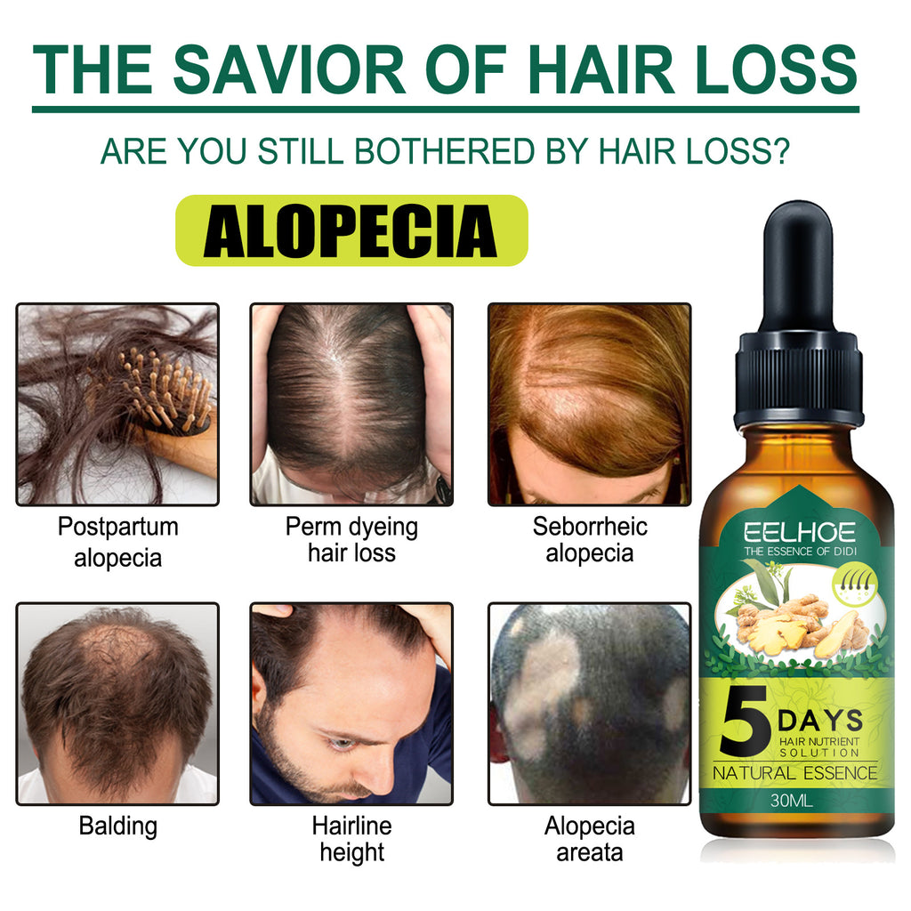 Eelhoe Ginger Hair Essential Oil