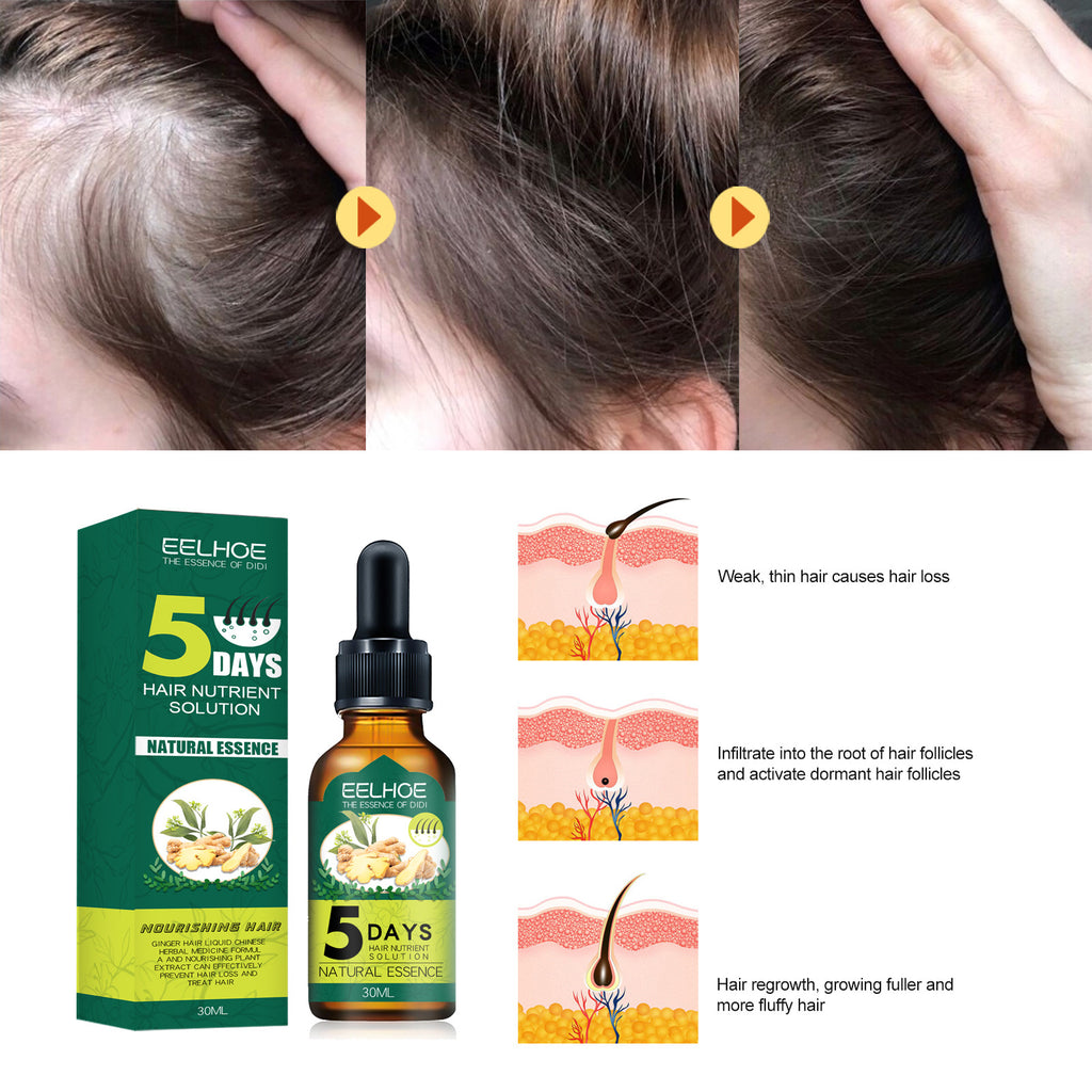 Eelhoe Ginger Hair Essential Oil