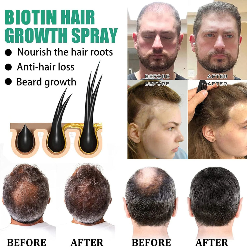 Hair Growth & Nourishing Serum – Anti Hair Loss Treatment (20ml)