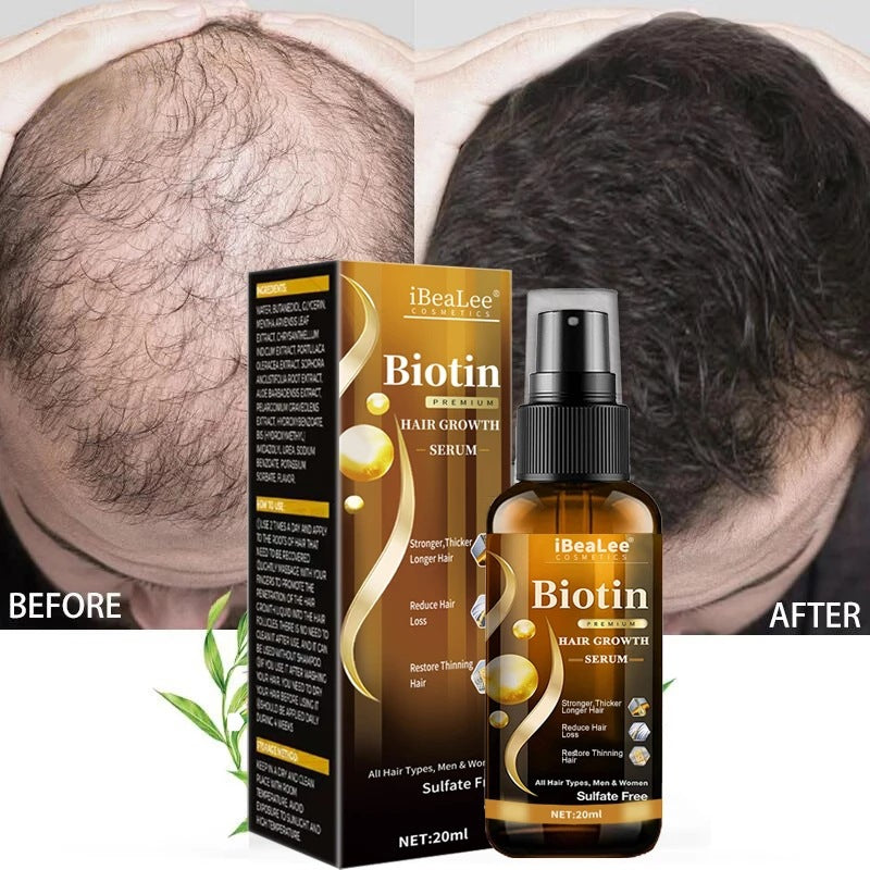 Hair Growth & Nourishing Serum – Anti Hair Loss Treatment (20ml)