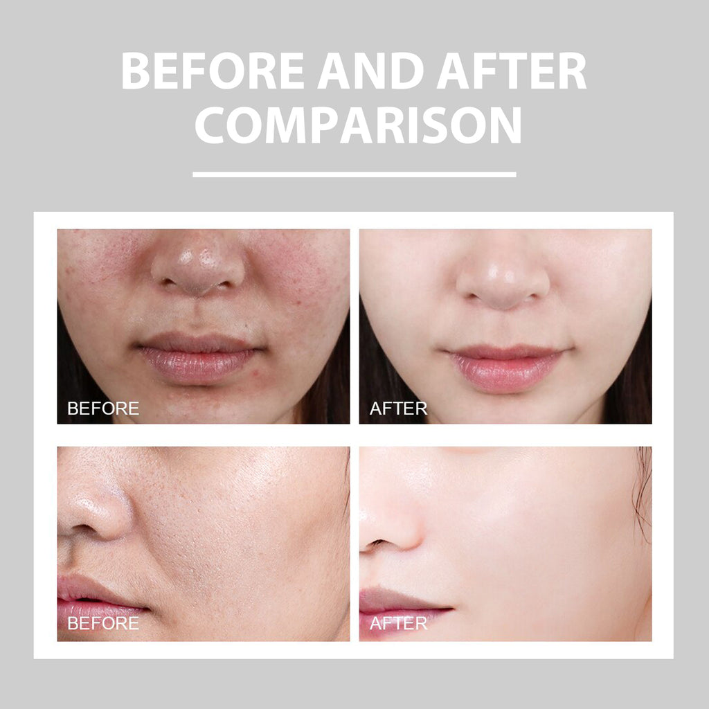 Eelhoe Hydrating Cream Hydrating And Lightening Facial