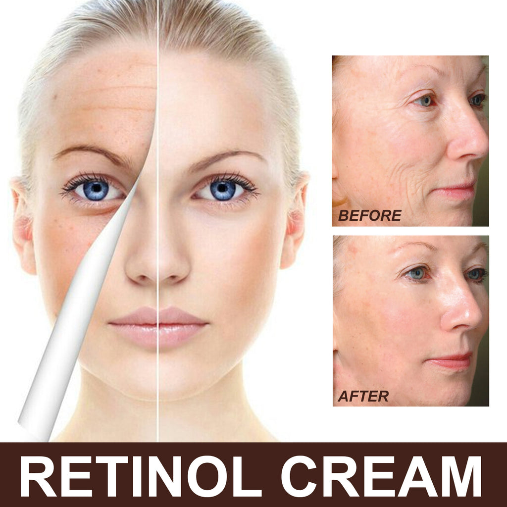 Retinol Anti-Aging Brightening Face Cream