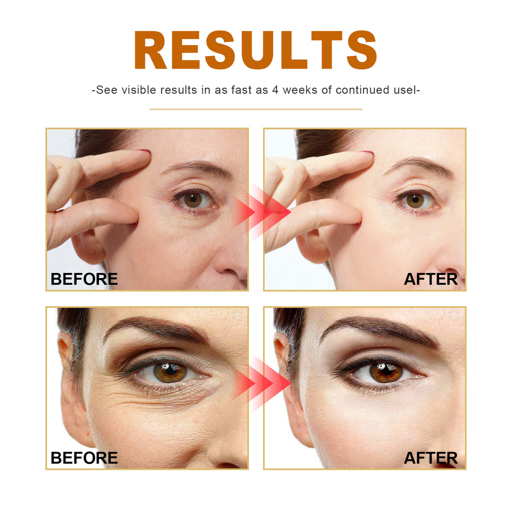 Collagen Anti-Wrinkle Spot-Fading Essence
